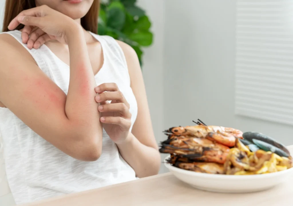 allergiogona trofima 1